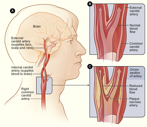 head arteries