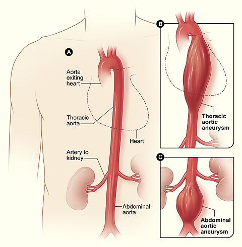 Arteries From Aorta